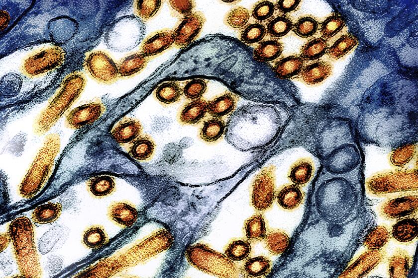 This colorized electron microscope image provided by the National Institute of Allergy and Infectious Diseases in 2024 shows avian influenza A virus (bird flu) particles, red/yellow, grown in cultured cells. (CDC, NIAID via AP)