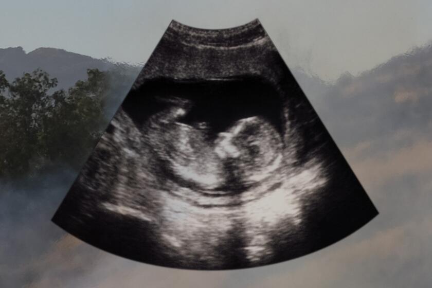 photo illustration of an ultrasound of a baby in utero over a photo of smoke from california wild fires